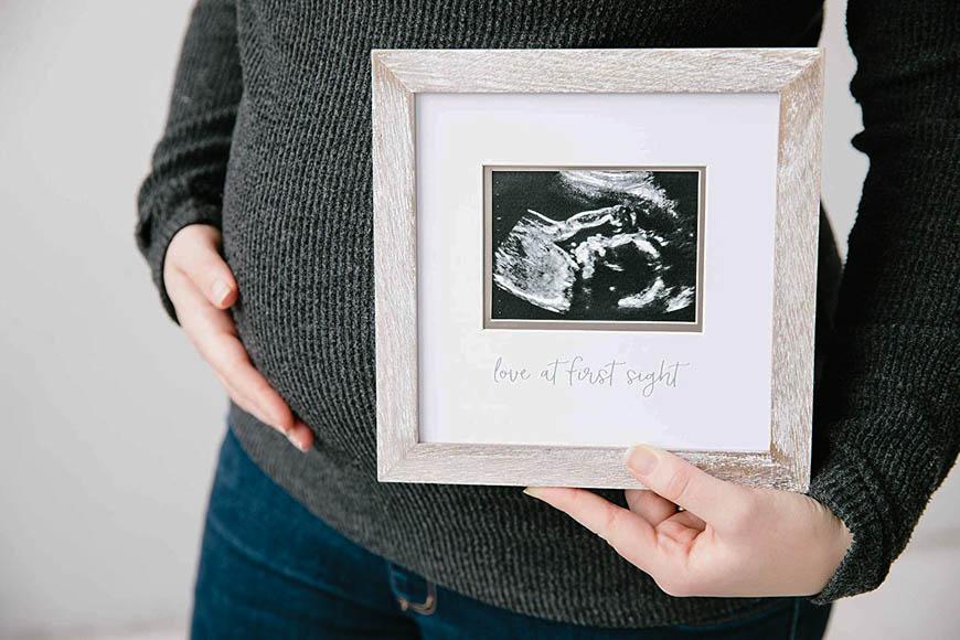 Έγκυος γυναίκα κρατάει λευκή κορνίζα με την ακτινογραφία του μωρού της.